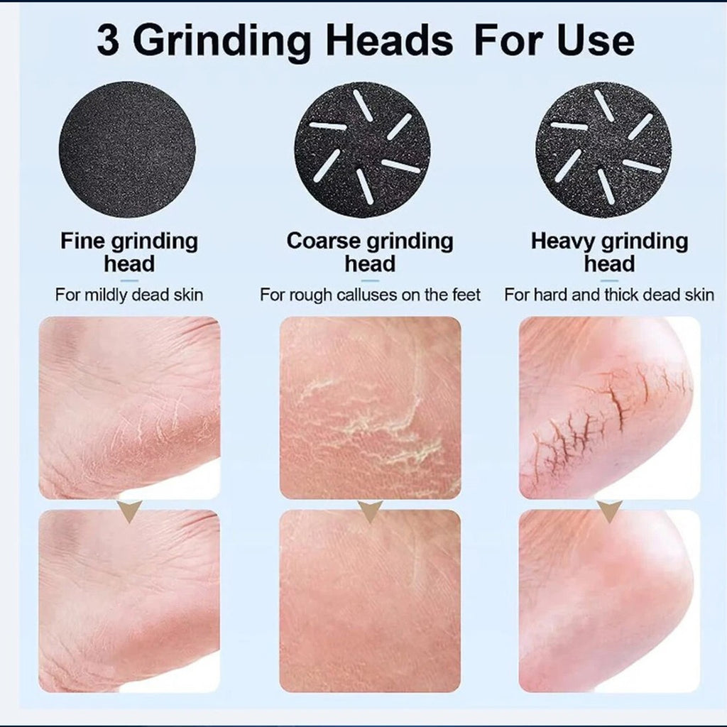 Electric Foot File Waterproof Hard Skin Remover Feet Pedicure Set Rechargeable